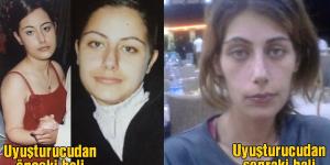 Kesik bacaktan “çekiçli” vahşet çıktı