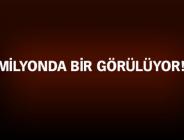 Siirt’te ‘yılan bebek’ doğdu!